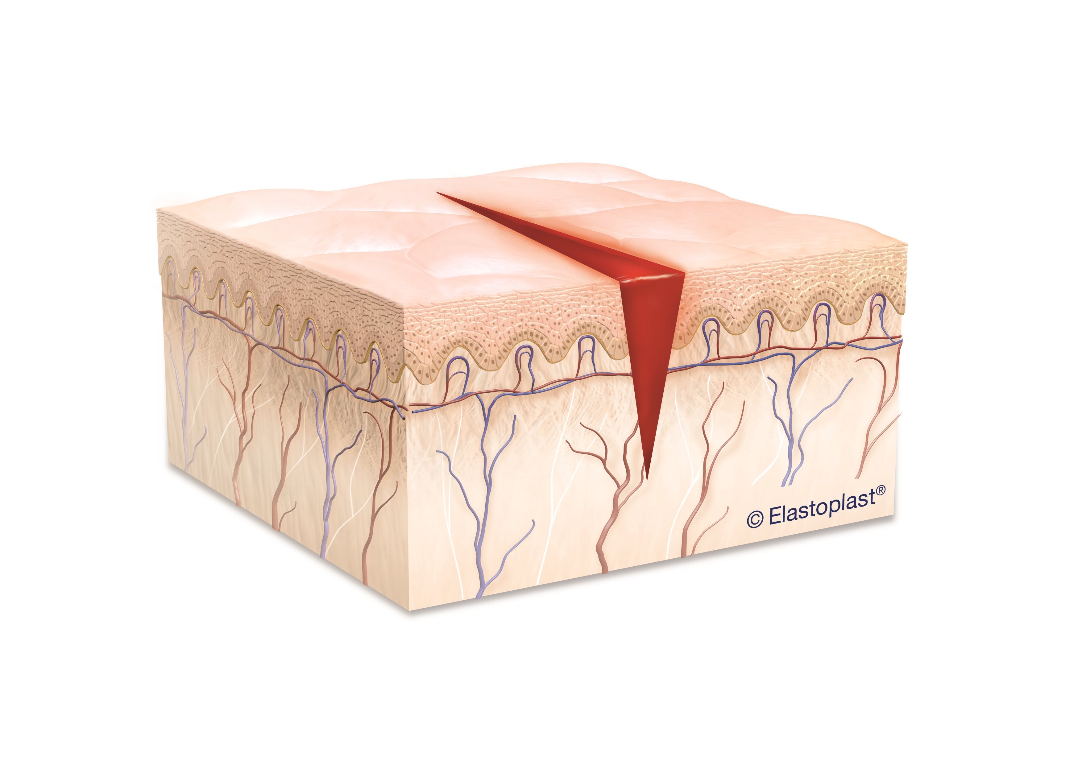 How To Know If A Cut Is Infected Elastoplast UK